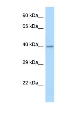 APOL4 / Apolipoprotein L 4 Antibody (aa67-116)