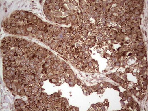MTDH / Metadherin Antibody (aa70-582, clone OTI6H2)