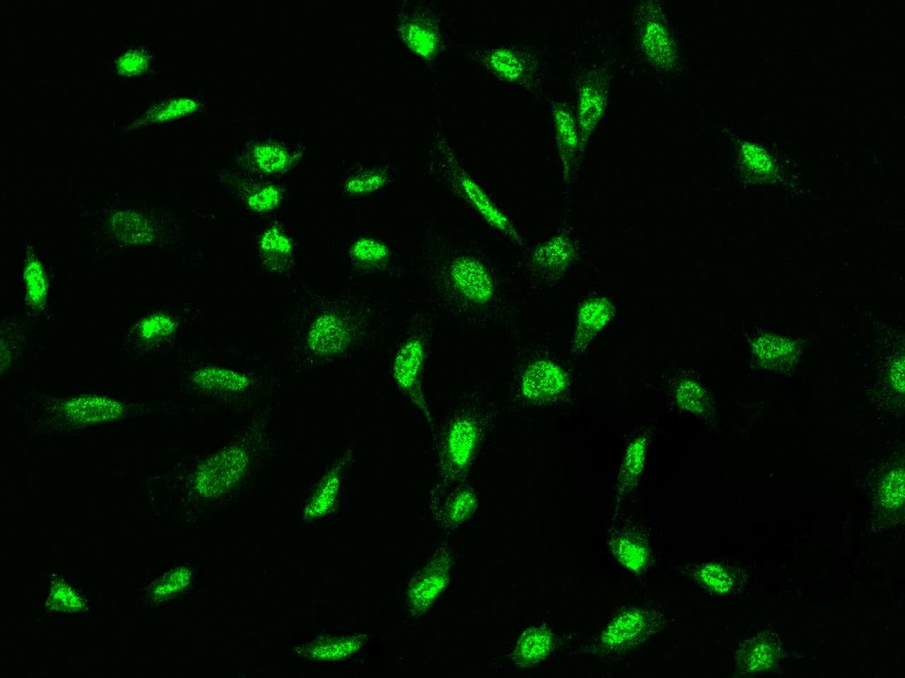 ADAMTSL4 Antibody