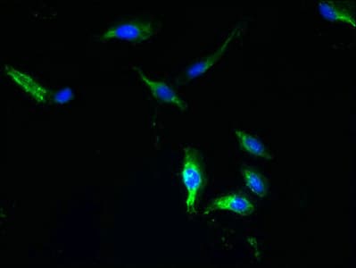 HTTY1 / TTYH1 Antibody