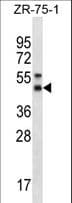 Polyclonal Rabbit anti-Human STX5 / Syntaxin 5 Antibody (aa180-209, WB)