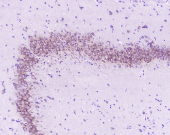 Polyclonal Rabbit anti-Human GOLGA2 / GM130 Antibody (IHC, WB)