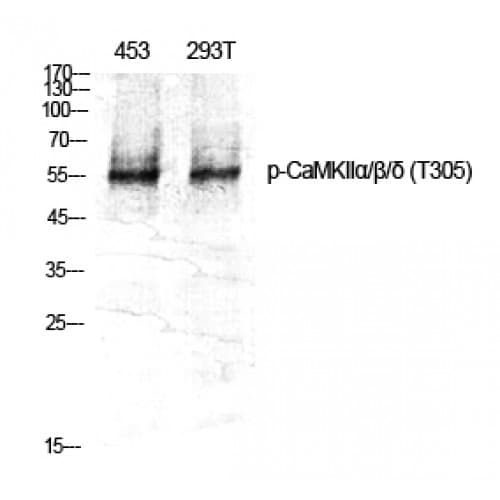 Polyclonal Rabbit anti-Human CaMKII Alpha+Beta+Delta Antibody (240-320 aa, IHC, WB)