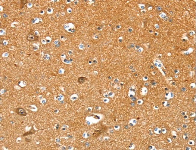 PYGL Antibody