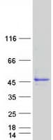 Human NDUFAF5 Protein (Recombinant Myc-DDK (Flag))