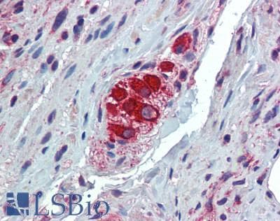 IHC-plus™ FKBP38 / FKBP8 Antibody (aa60-270)