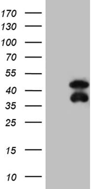 BCL7B Antibody (clone OTI2D9)