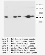 CASP3 / Caspase 3 Antibody (C-Terminus)