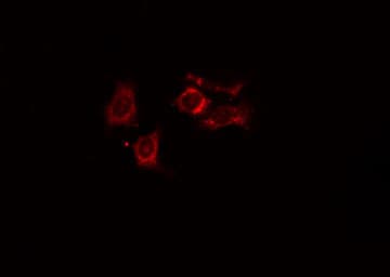 NDRG4 Antibody
