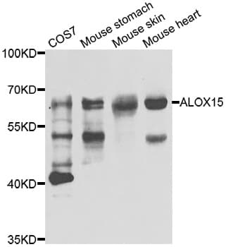 ALOX15 / 15-Lipoxygenase Antibody
