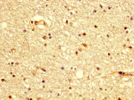 BDKRB2/Bradykinin B2 Receptor Antibody