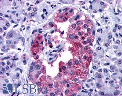 IHC-plus™ GIPR / GIP Receptor Antibody (N-Terminus)