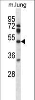 PDK4 Antibody (aa82-110)