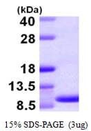 Human CCL15 / MIP5 Protein (Recombinant)