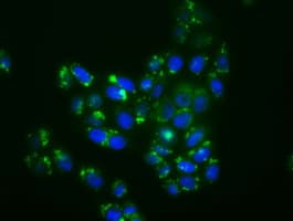 MAPK11 / SAPK2 / p38 Beta Antibody (clone OTI1C2)