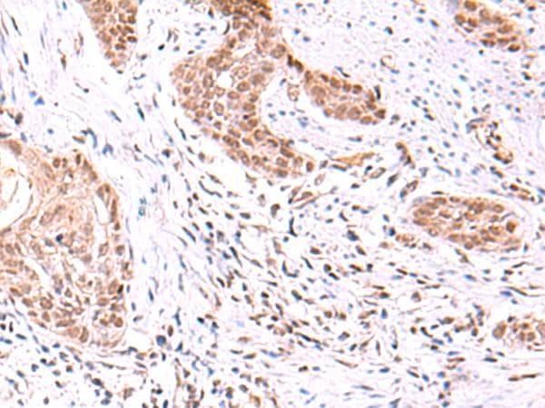 TYW2 / TRMT12 Antibody