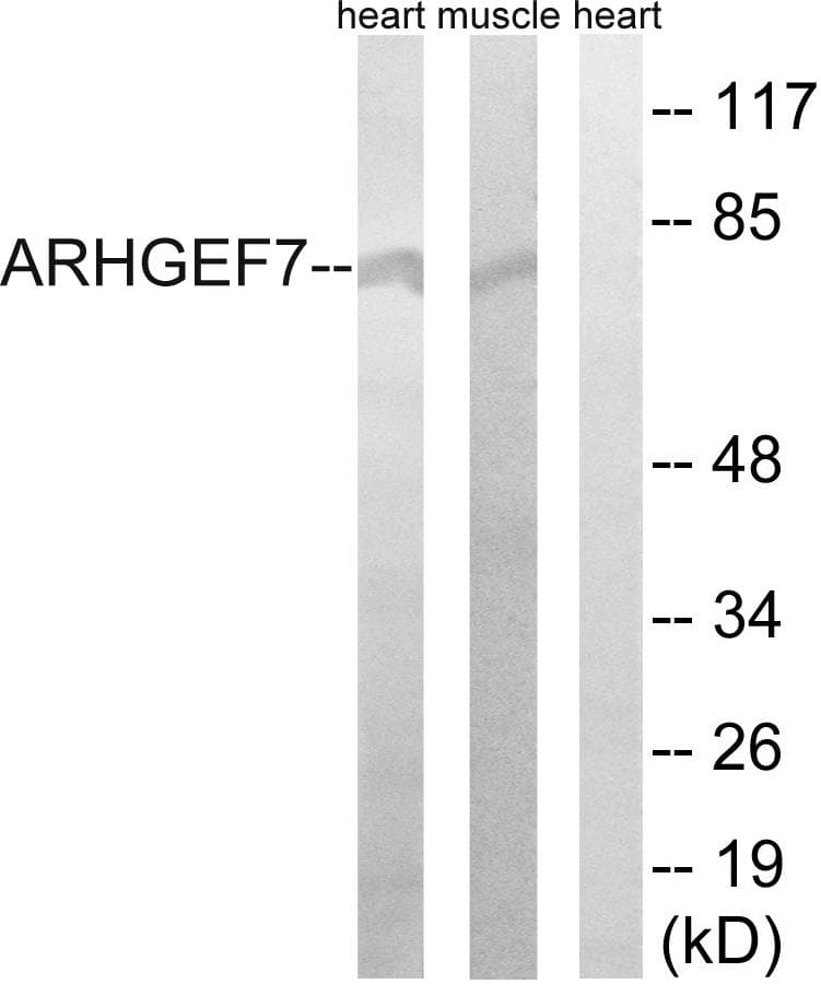 ARHGEF7 Antibody