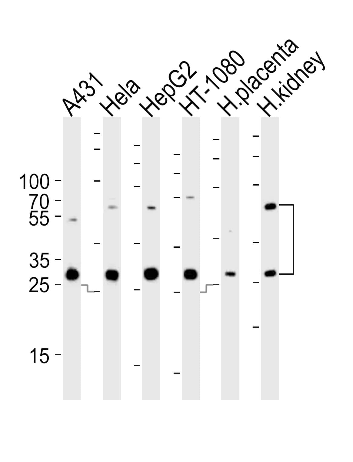 IHC-plus™ Polyclonal Rabbit anti-Human CTSA / Cathepsin A Antibody (aa18-45, IHC, WB)