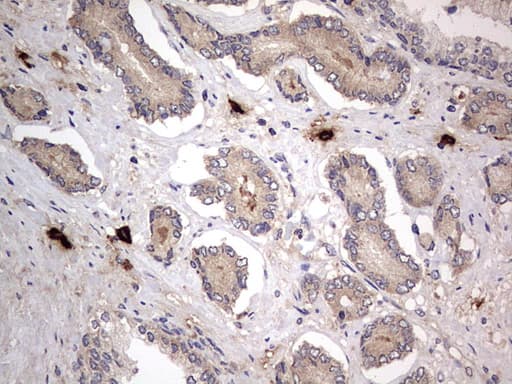 Monoclonal Mouse anti-Human SMPD1 / Acid Sphingomyelinase Antibody (clone OTI3H7, aa62-341, IHC, WB)