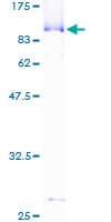 Human CSTF2 / CstF-64 Protein (Recombinant GST)