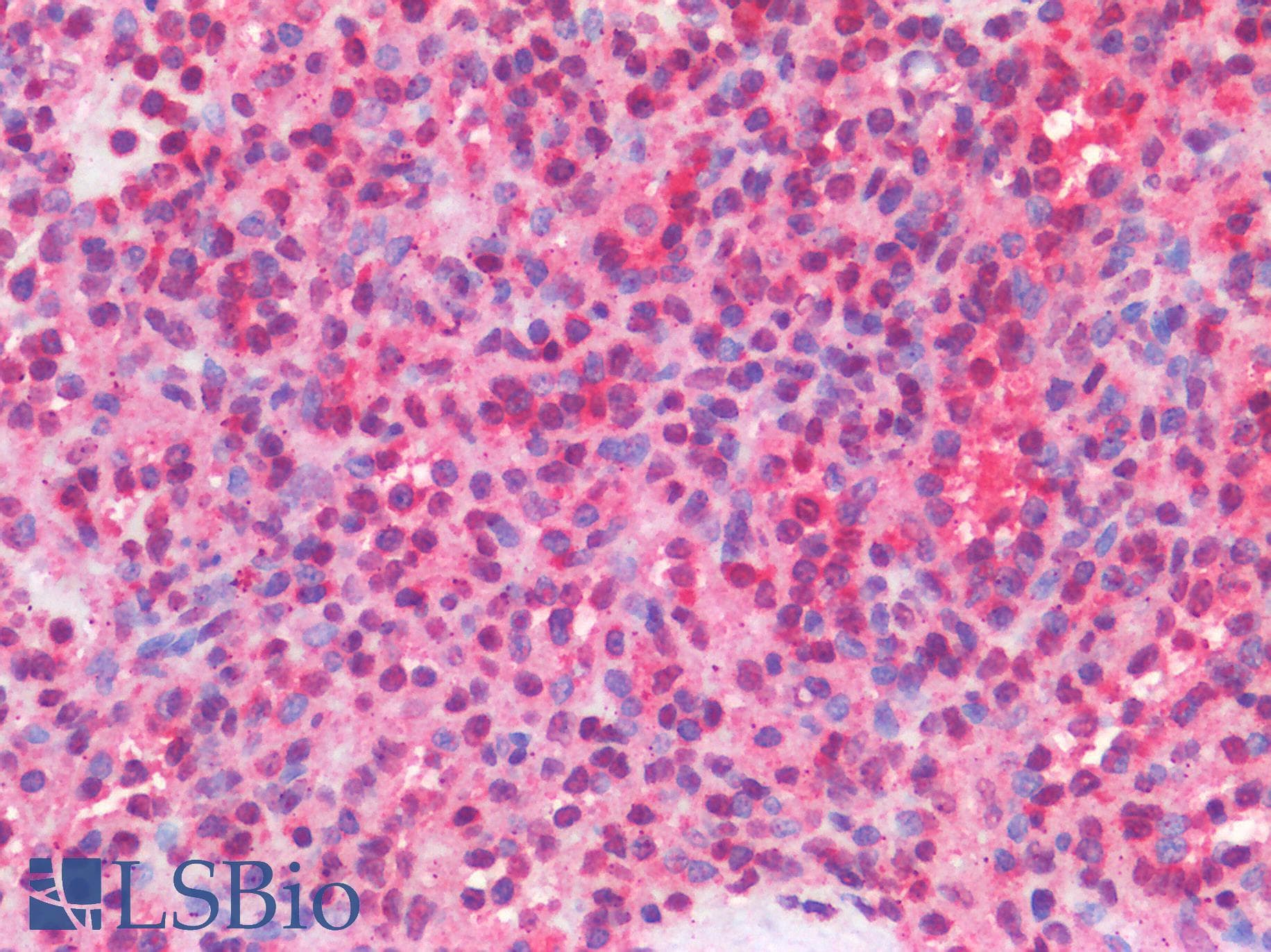 IHC-plus™ IL3RA / CD123 Antibody