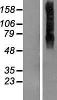 TMEM175 / MGC4618 Protein (Over-Expression Lysate Myc-DDK (Flag))