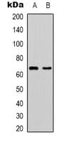 PAK1 Antibody (Internal)