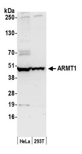 ARMT1 Antibody (aa50-100)