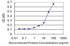 IHC-plus™ CHD1 Antibody (clone 1G2)
