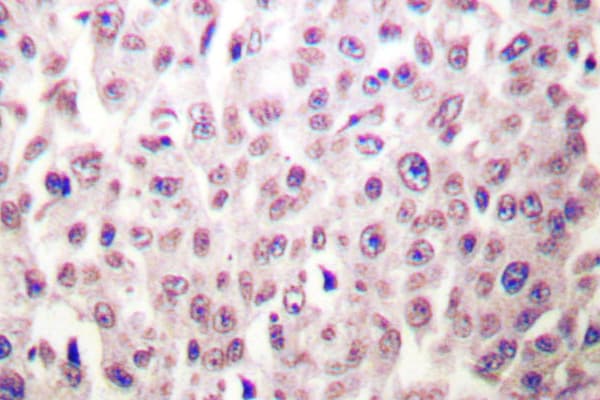 Polyclonal Rabbit anti-Human DDIT3 / CHOP Antibody (Lys121, IHC, IF, WB)