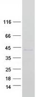 Human MARCH2 Protein (Recombinant Myc-DDK (Flag))