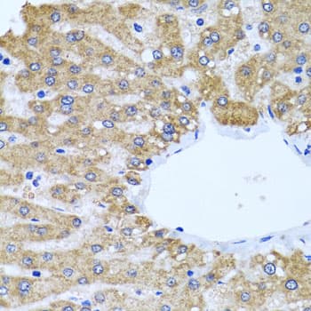 CCM2 / Malcavernin Antibody