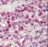 MMP9 / Gelatinase B Antibody (aa644-673)