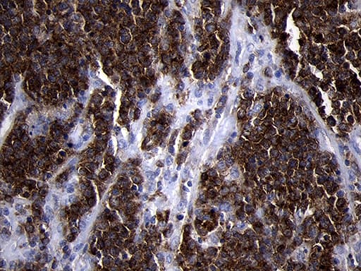 CD79B / CD79 Beta Antibody (clone OTI4E11, Carrier-free)