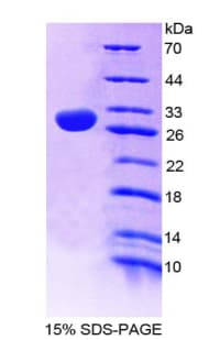 Human NOS1AP / CAPON Protein (Recombinant His-T7)