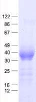 Human CHIA / Amcase Protein (Recombinant His, N-Terminal)