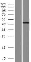 Human CD1E Protein (Over-Expression Lysate Myc-DDK (Flag))