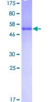 Human SNRPA / U1A Protein (Recombinant GST)