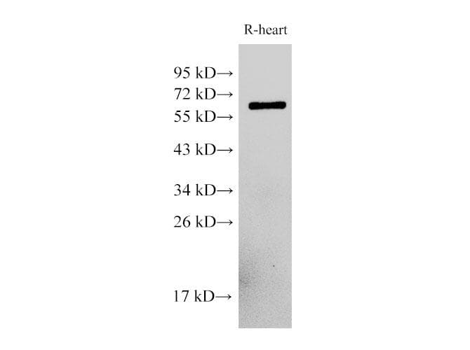 Polyclonal Rabbit anti-Human PDCD4 Antibody (IHC, WB)