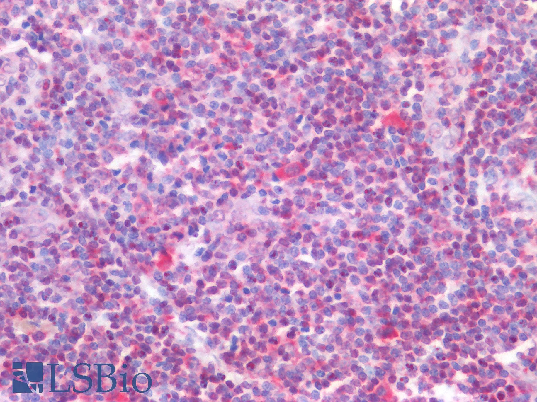 PathPlus™ Polyclonal Rabbit anti-Human FOXP1 Antibody (aa650-677, IHC, WB)