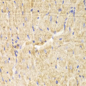 Polyclonal Rabbit anti-Human PDLIM5 / LIM Antibody (IHC, IF, WB)