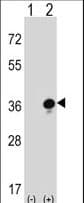 GZMB / Granzyme B Antibody (aa175-203)