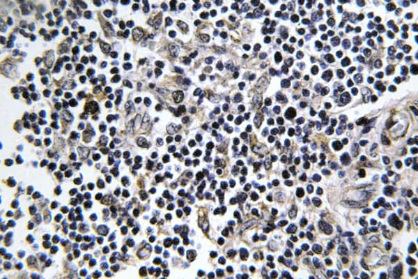 Polyclonal Rabbit anti-Human ARFIP1 Antibody (Lys314, IHC, IF, WB)