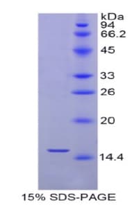 Human SEPX1 / Selenoprotein R (Recombinant His)