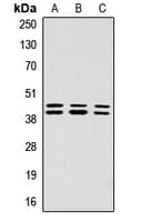 ERK1 + ERK2 Antibody (phospho-Thr202/Tyr204)