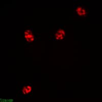 Polyclonal Rabbit anti-Human MKI67 / Ki67 Antibody (IHC, IF, WB)