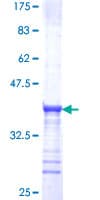 Human TRPA1 Protein (Recombinant GST, N-terminus)