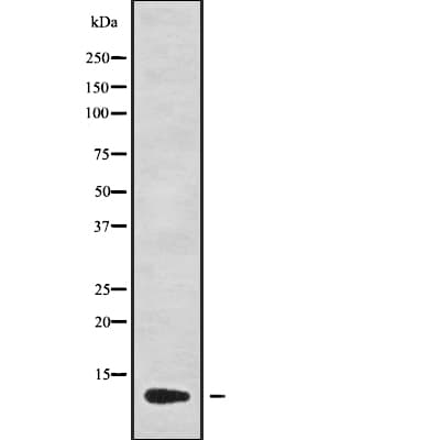 Polyclonal Rabbit anti-Human CCL13 / MCP4 Antibody (IHC, WB)