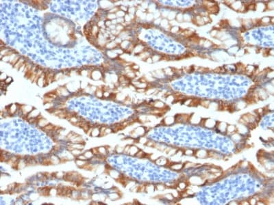 KRT8 / CK8 / Cytokeratin 8 Antibody (clone KRT8/2174R)