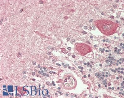 KCTD10 Antibody (C-Terminus)